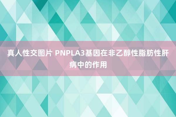 真人性交图片 PNPLA3基因在非乙醇性脂肪性肝病中的作用